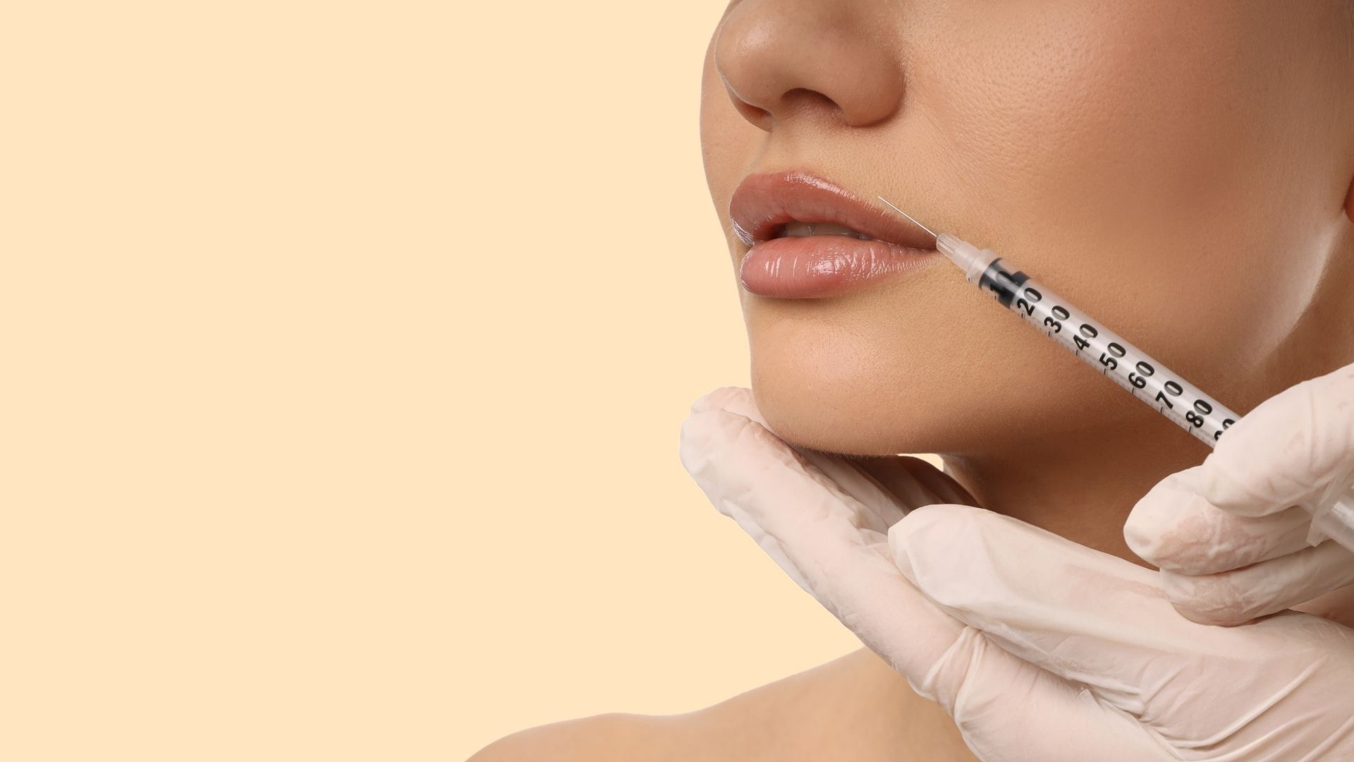 Lip Fillers Done Right: How to Get Natural Results (And Avoid the ‘Duck Lip’ Look)